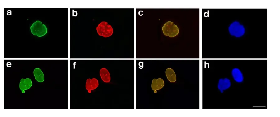Núcleos de células de uma pessoa com progéria vistos ao microscópio. A forma irregular vem da lamina A alterada. Imagem: Paradisi, McClintock, Boguslavsky, Pedicelli, Worman e Djabali, CC BY 2.0